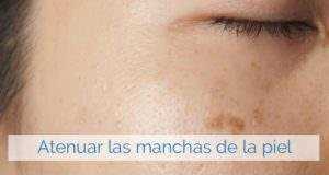 Remedios caseros para las manchas de la piel.