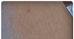 Se eleva a 4 el número de niñas agredidas con pinchazos en la Feria Chica