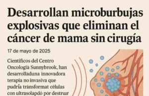 Desarrollan microburbujas explosivas que eliminan el cáncer de mama sin cirugía
